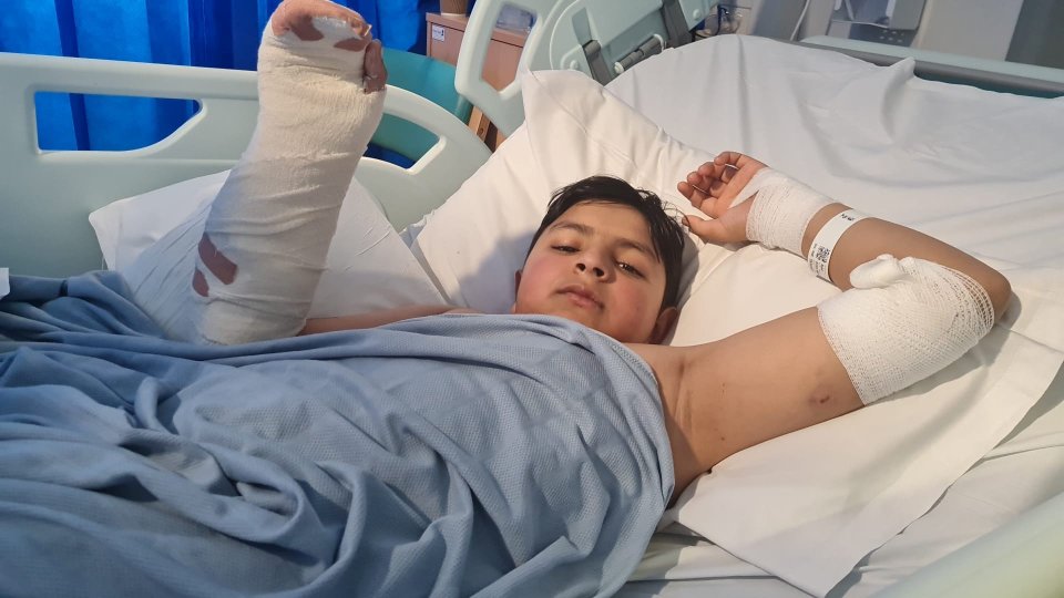 Mohid Gardazee, 12, was raced to hospital after he was mauled by one of the hounds in Oldham last year