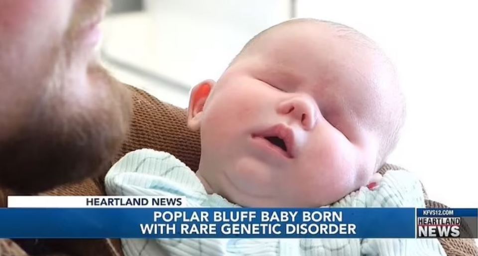 Their baby was born with a rare genetic condition that affects less than 30 people worldwide