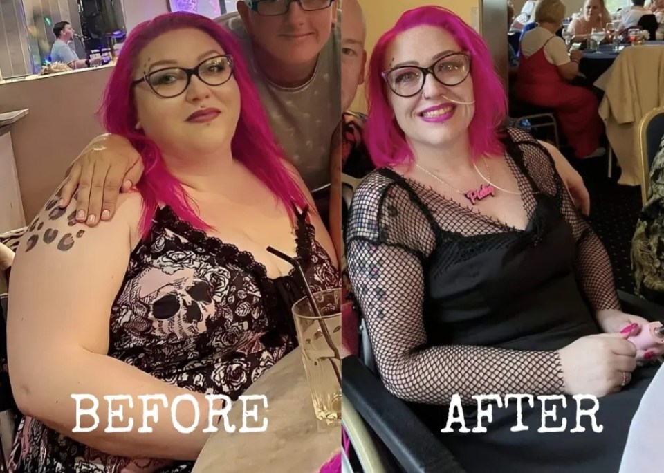 Pinky said she lost four stone in four weeks – but she nearly died