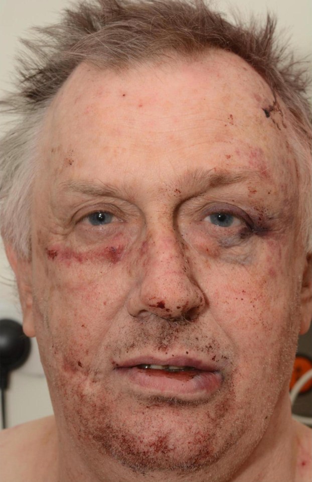 Whiting pictured after a previous jail attack