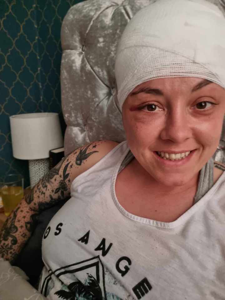 Jess, who underwent chemotherapy and radiotherapy, post-surgery