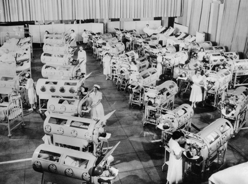 Nurses attend to a room full of polio patients in iron lung respirators in California in the 1950s