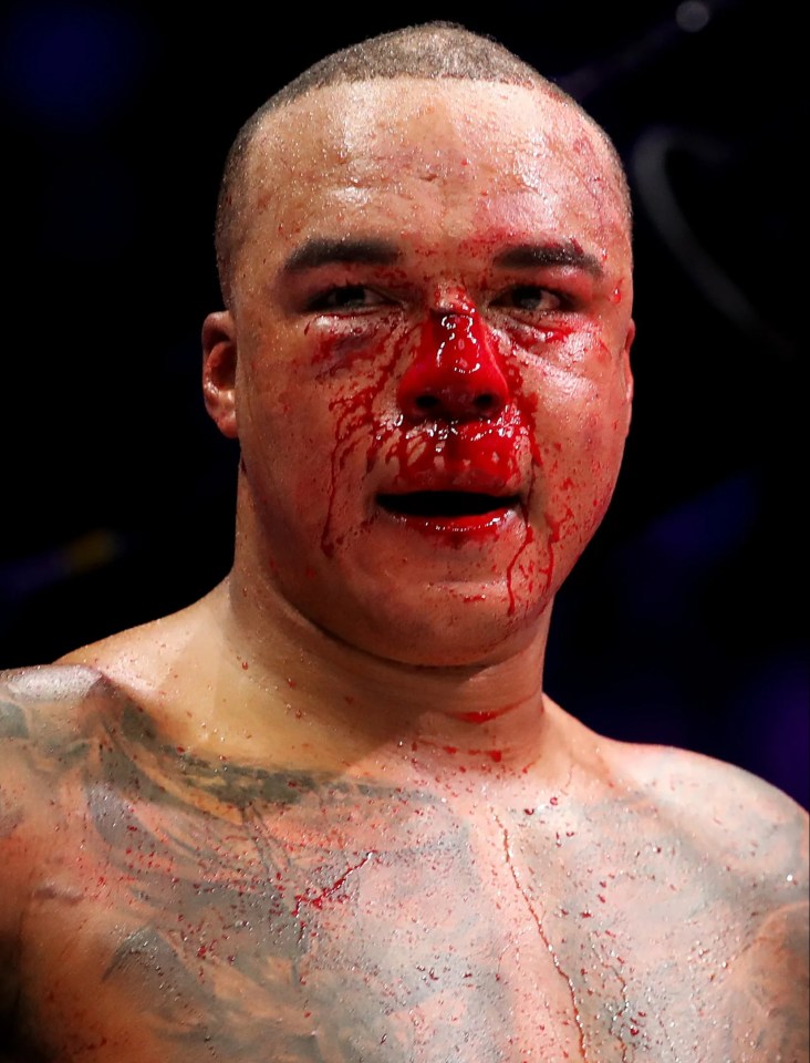 Bloodied Fabio Wardley too the fight all the way and earned a draw