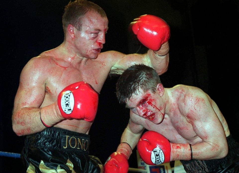 Ricky Hatton suffered this cut against Jon Thaxton