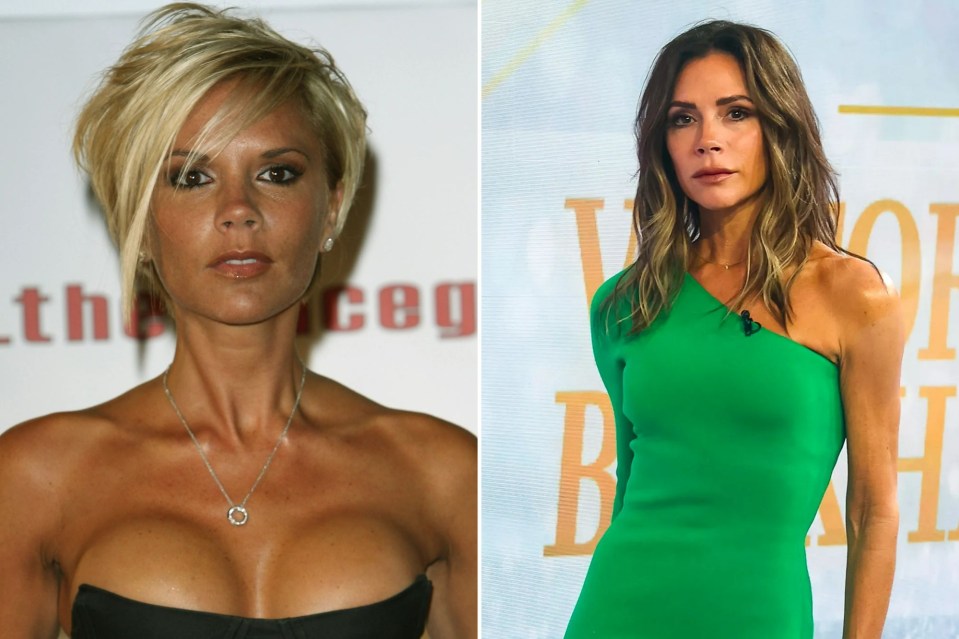 Victoria Beckham denied having plastic surgery until later, when she had her implants removed