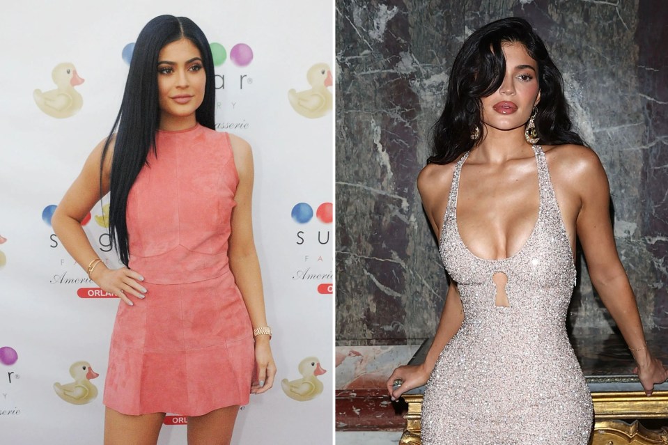 Kylie Jenner has expressed regret over having the cosmetic procedure at the age of just 19