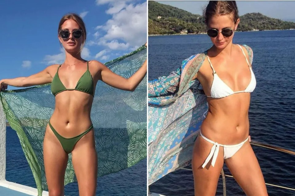 Millie Mackintosh has been left “thrilled” with the results of her chest treatment