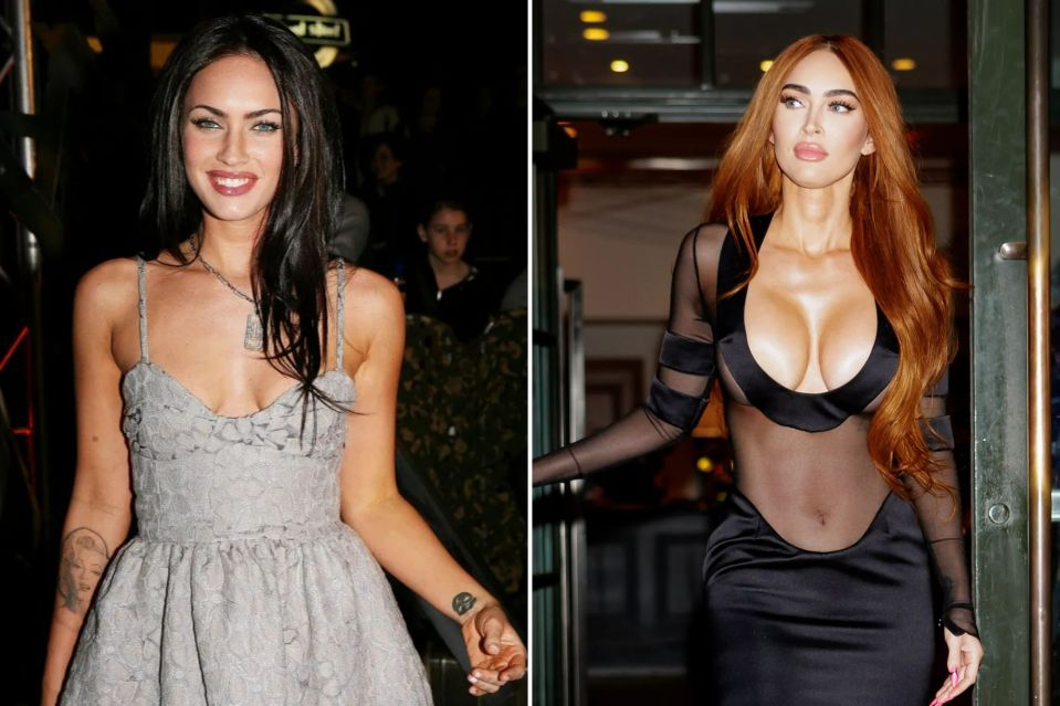 Megan Fox recently revealed she'd spent thousands to transform her chest