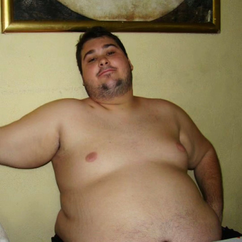 A man from Brazil used to weigh 440 pounds