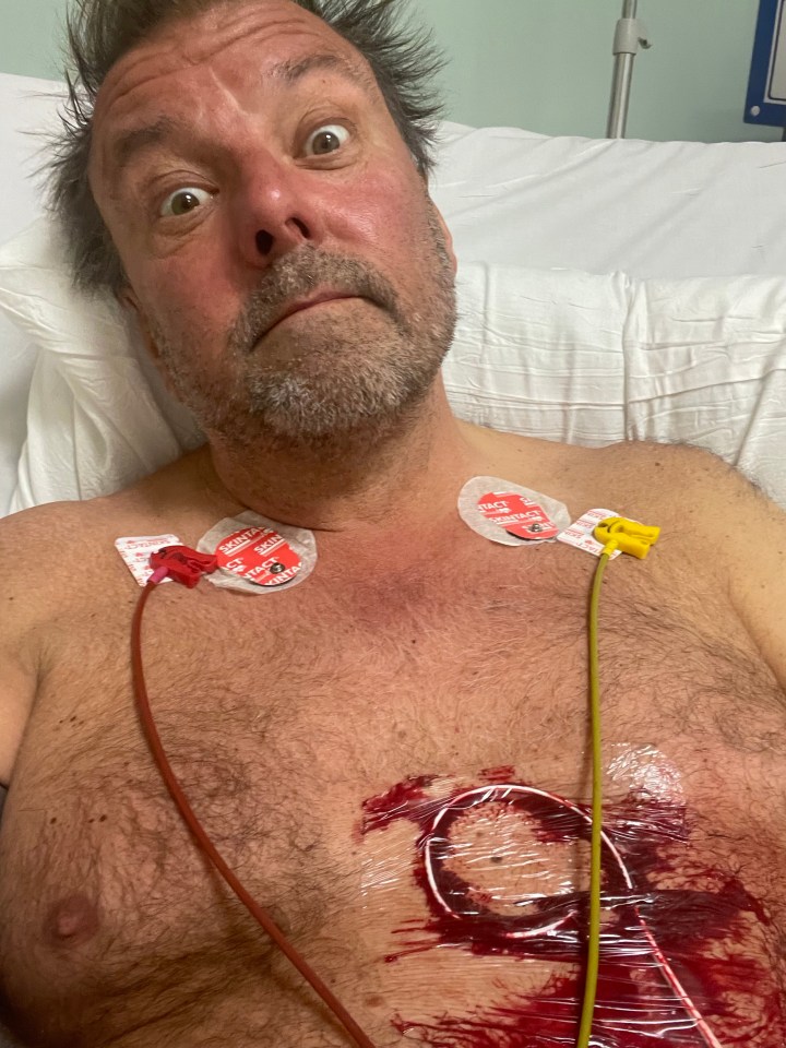 Martin Roberts revealed that he was told had ‘less than a few hours to live’