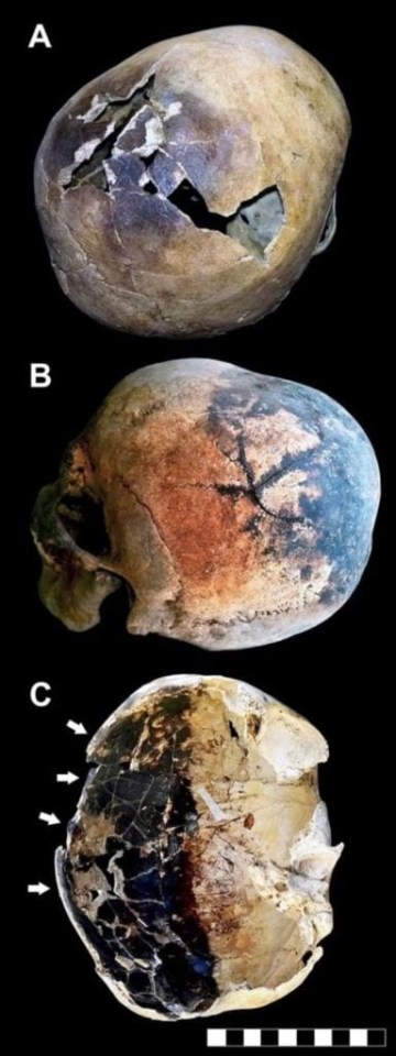 Several of the skeletons’ skulls had gaping holes and stains