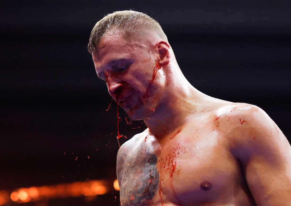 Briedis was left a bloody mess after his crushing defeat