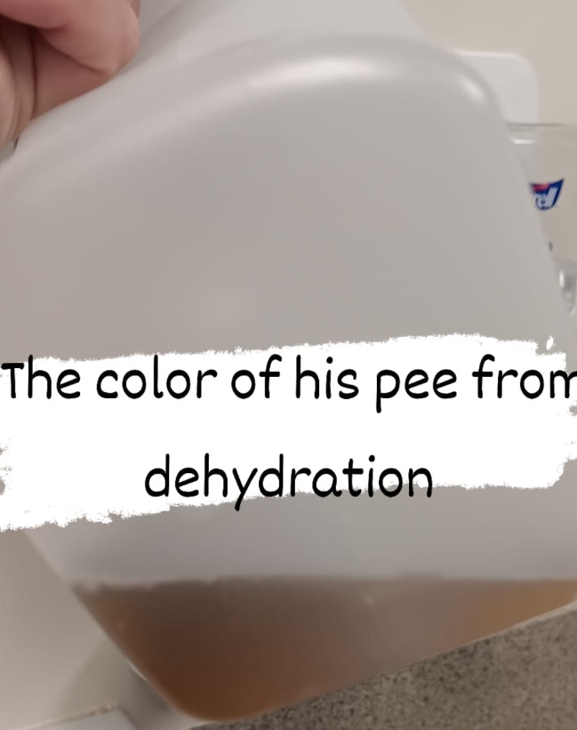 Jake was so dehydrated his urine was ‘almost black’