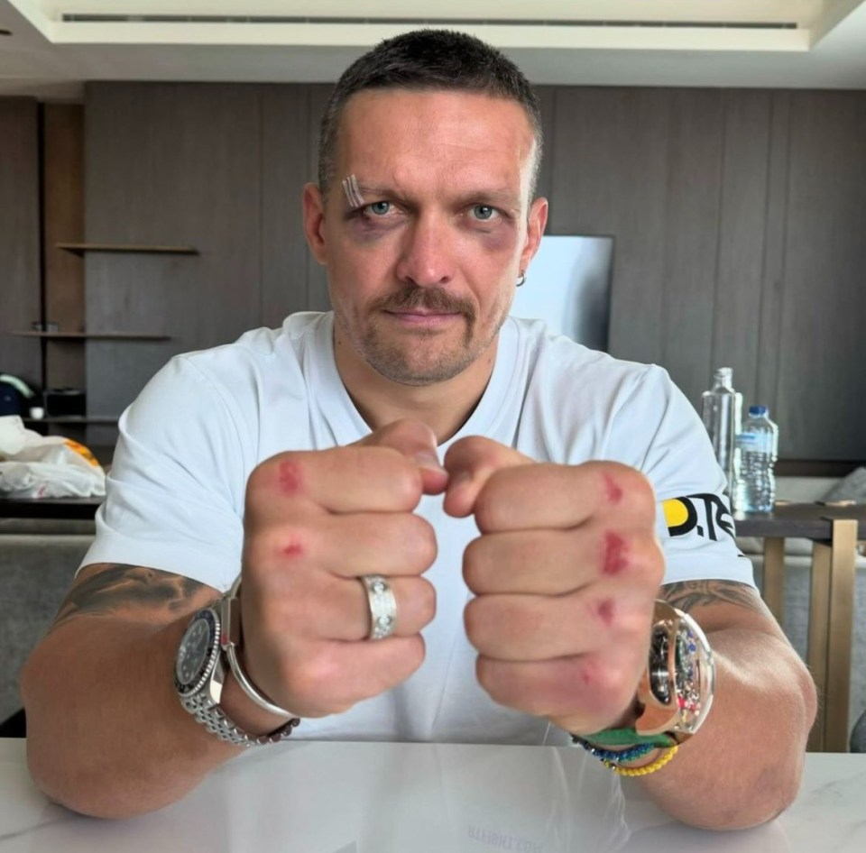 Oleksandr Usyk showing off his brutal injuries