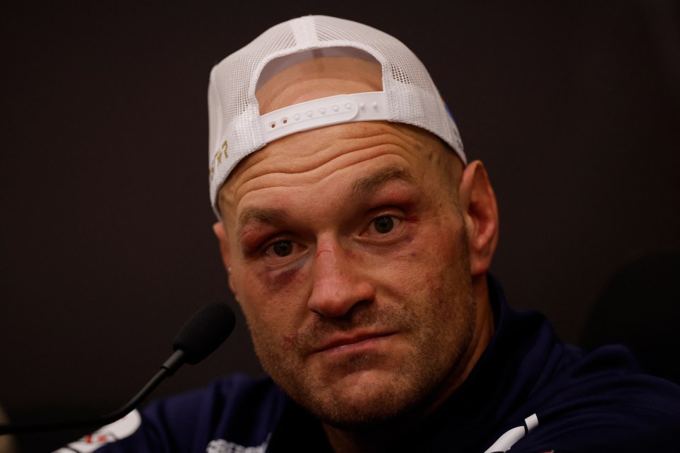 Fury suffered significant damage to his right eye against Oleksandr Usyk