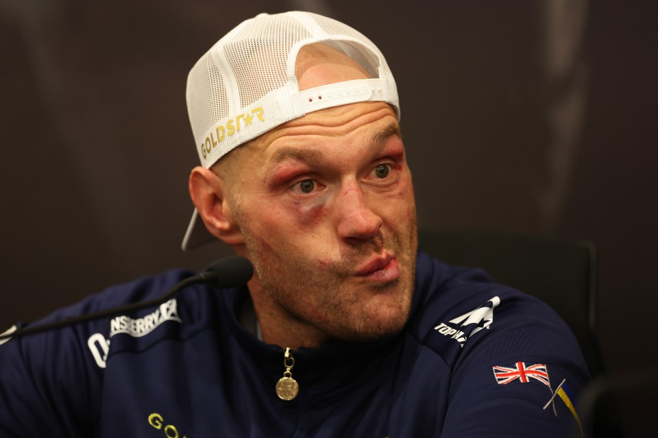 The Gypsy King admitted his face was “battered”