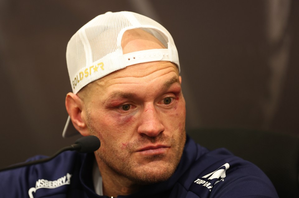 Tyson Fury was slapped with a medical boxing suspension after his loss to Oleksandr Usyk