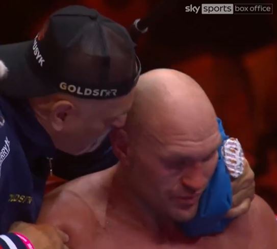 John Fury's cornering came under criticism