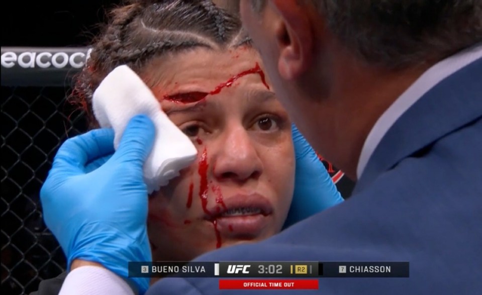 The cageside doctor called off the fight after seeing the severity of her wound