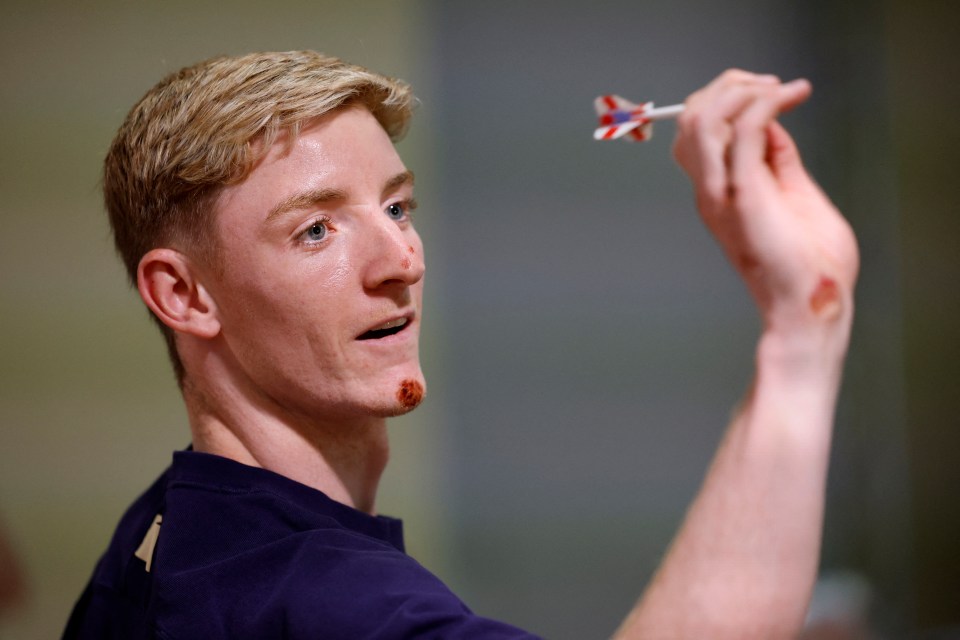 Gordon plays darts before the press conference