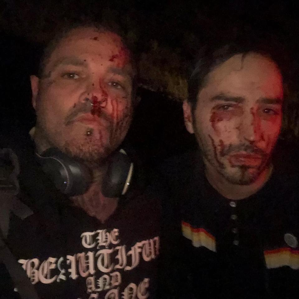 Seth and Elias Tannous were covered in blood after the crash