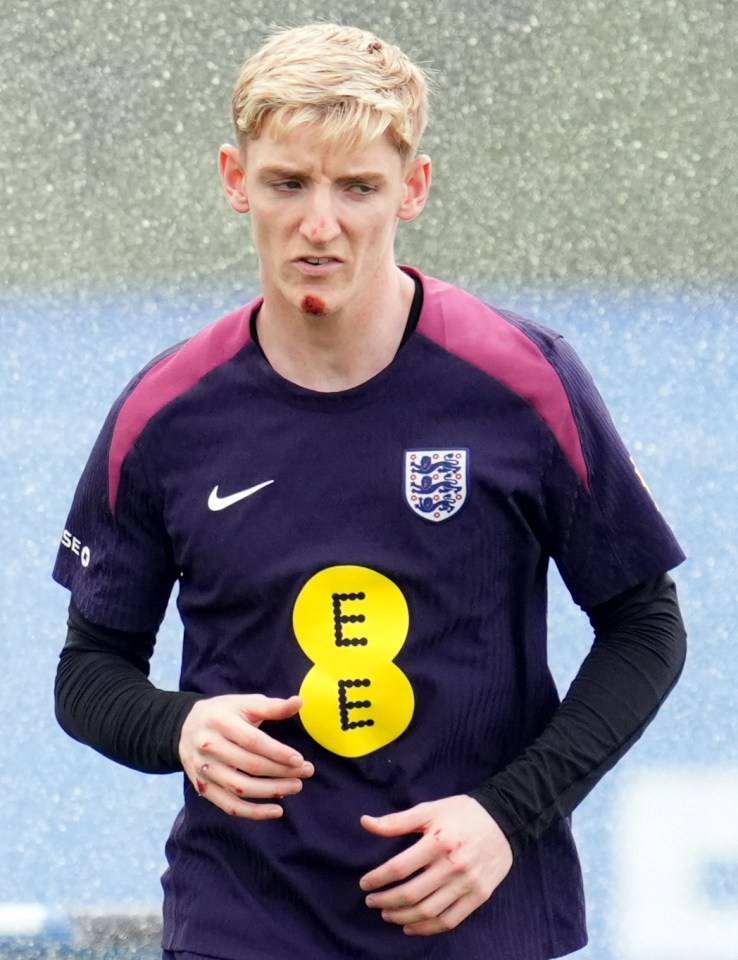 Anthony Gordon was spotted with a plaster on his chin during England training