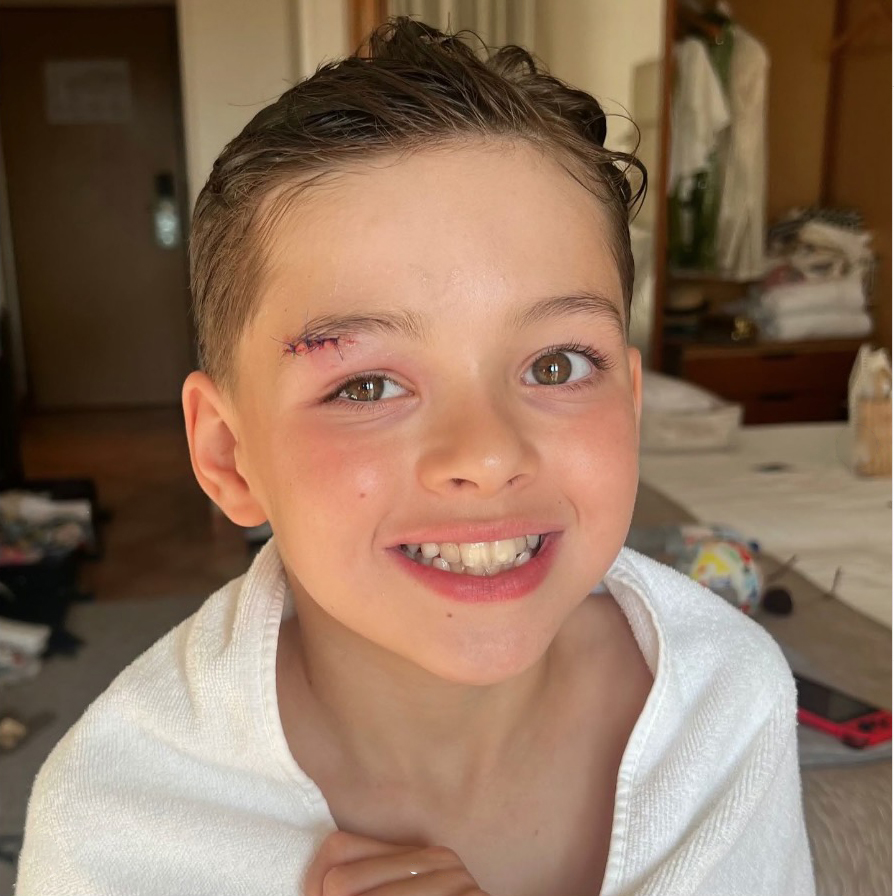 The youngster, nine, needed stitches above his eye following a mishap