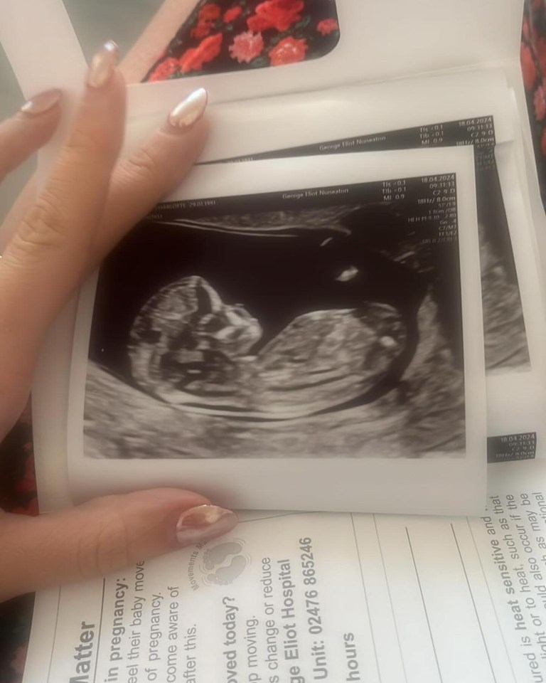 She announced her pregnancy news with a snap of her scan