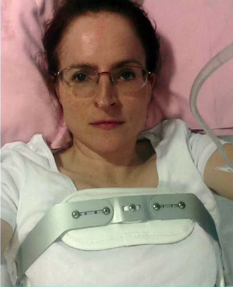 a woman wearing glasses and a brace on her chest