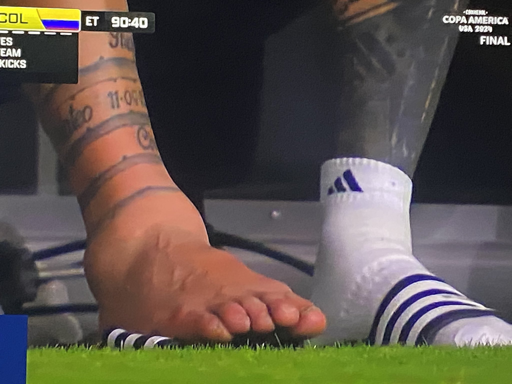 Messi suffered a nasty-looking ankle injury