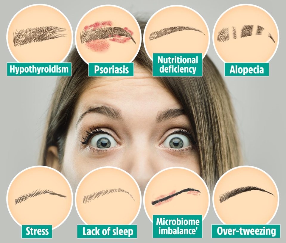 Your eyebrows can reveal the state of your health