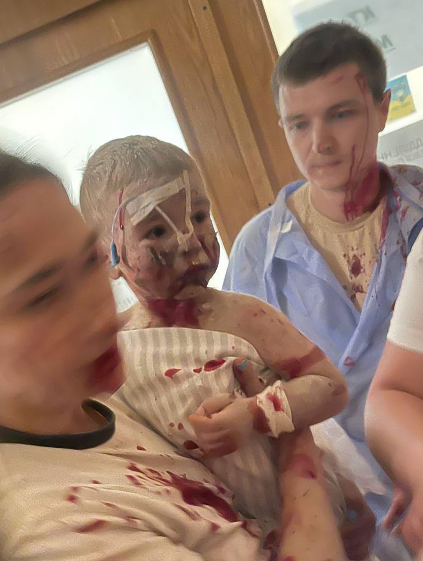 A bloodied toddler receives medical treatment in hospital