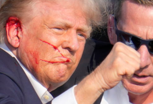 Blood smeared across the side of Trump's face after the shooting