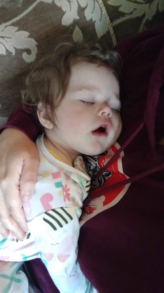 Beatrix’s face, hands and feet swelled up over time after she and her siblings were struck with stomach bug symptoms