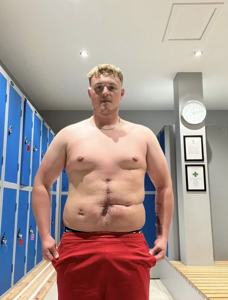 Connor turned to food to deal with the traumatic incident and gained over seven stone