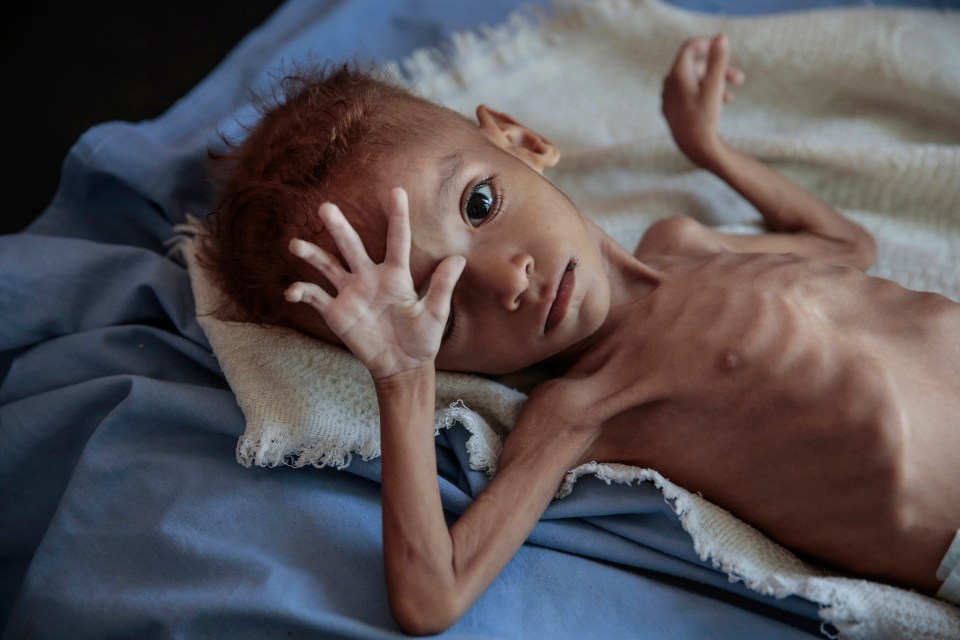 Thousands of children have died from starvation