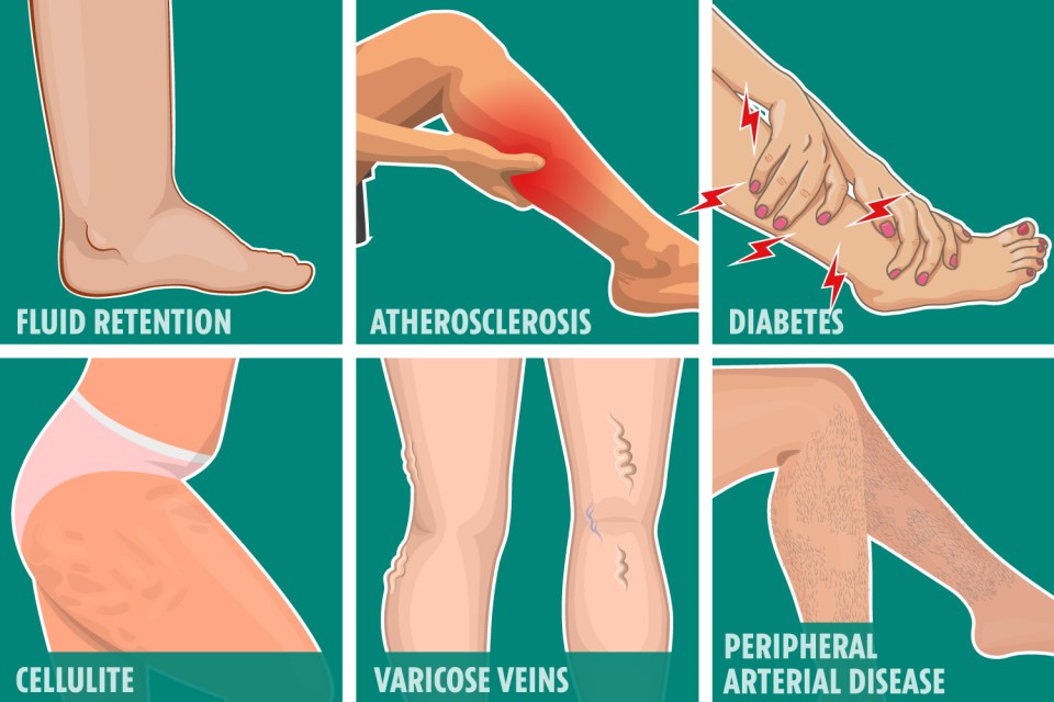 From visible veins to hair loss on your legs – your pins have a lot to say about your health