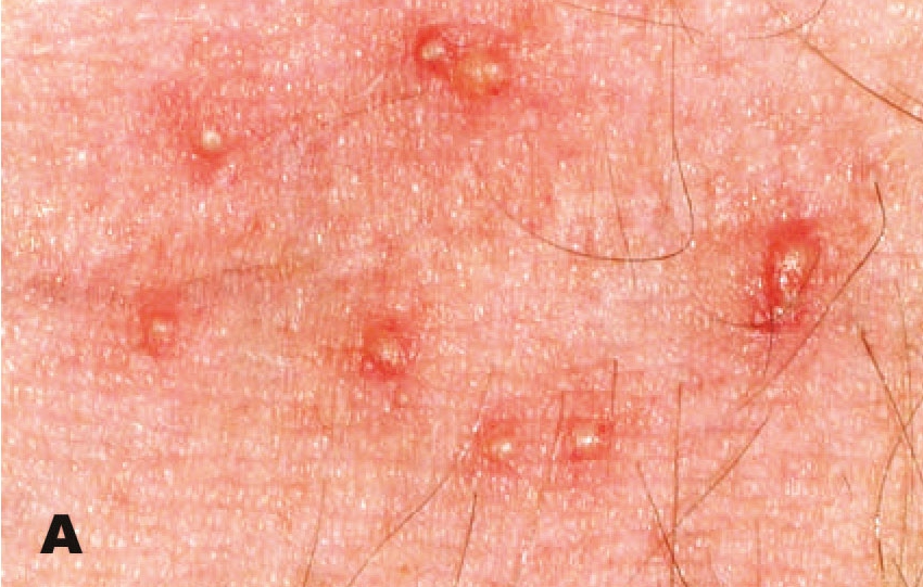 a close up of a person 's skin with the letter a below it