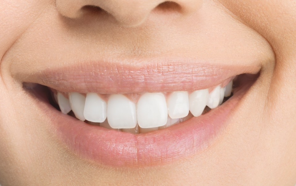 a close up of a woman 's smile with white teeth