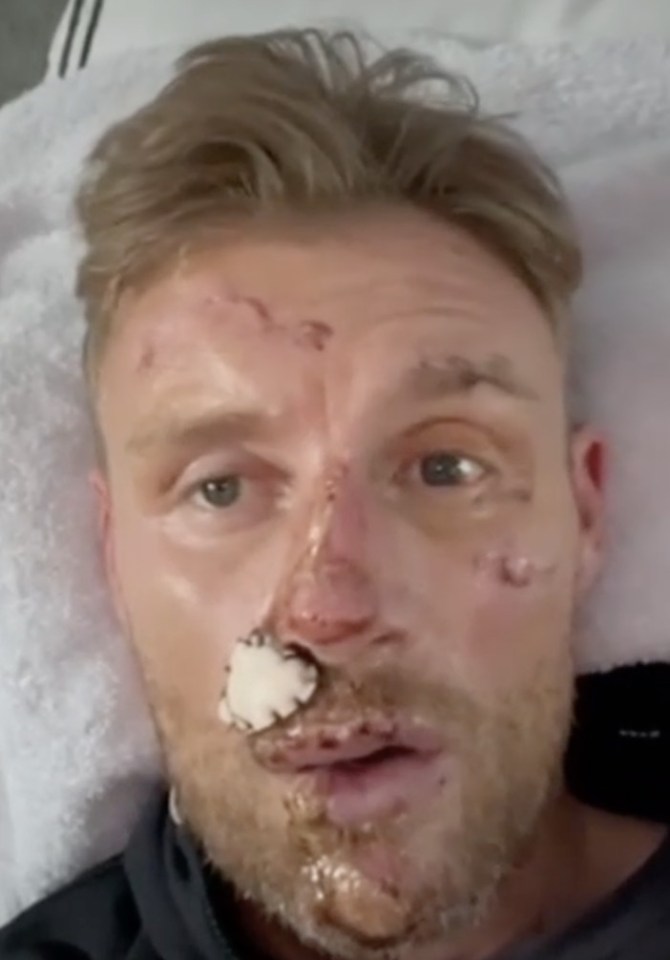 a man with a bandage on his nose is laying in a hospital bed .