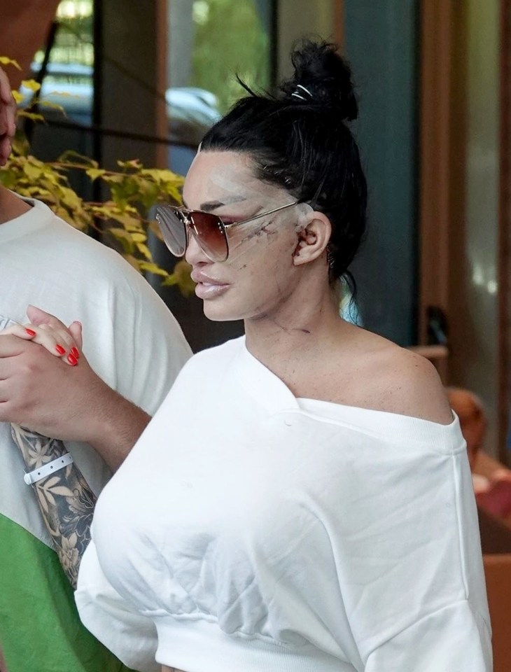 Katie Price held her son Harvey's hand as she left her hotel after her sixth face lift