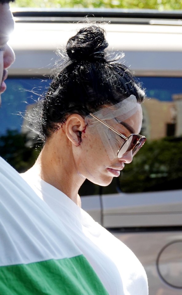 The former glamour model was spotted with bloodied ears and bandages across her face