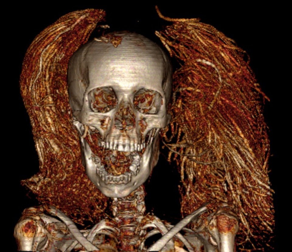 CT scan of the mummy shows her twisted face that was left wide open