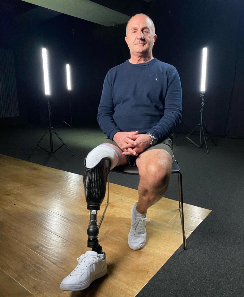 David Ward, pictured in a new documentary, survived but lost his leg