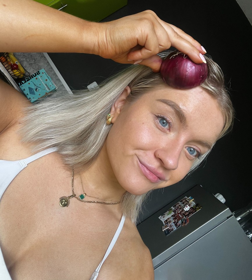 The DIY remedy calls for using onion juice on your scalp - but does it actually work? I set out to see for myself