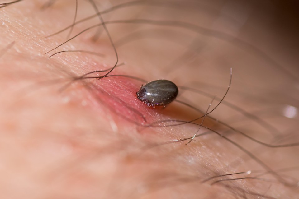 a close up of a tick on a person 's skin