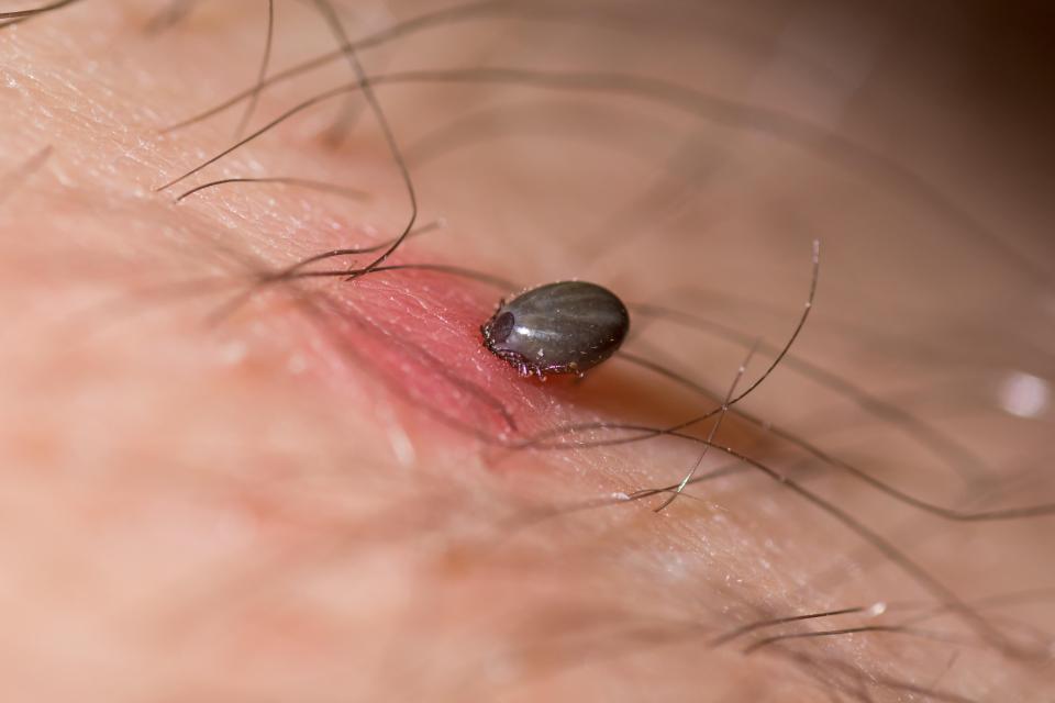 Ticks in England can carry Lyme disease and a brain swelling disease called tick-borne encephalitis