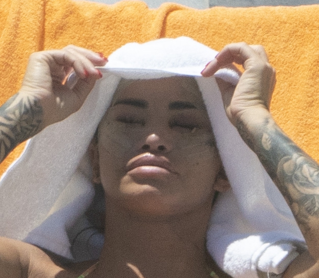 Katie covered her face lift and new teeth with a white towel