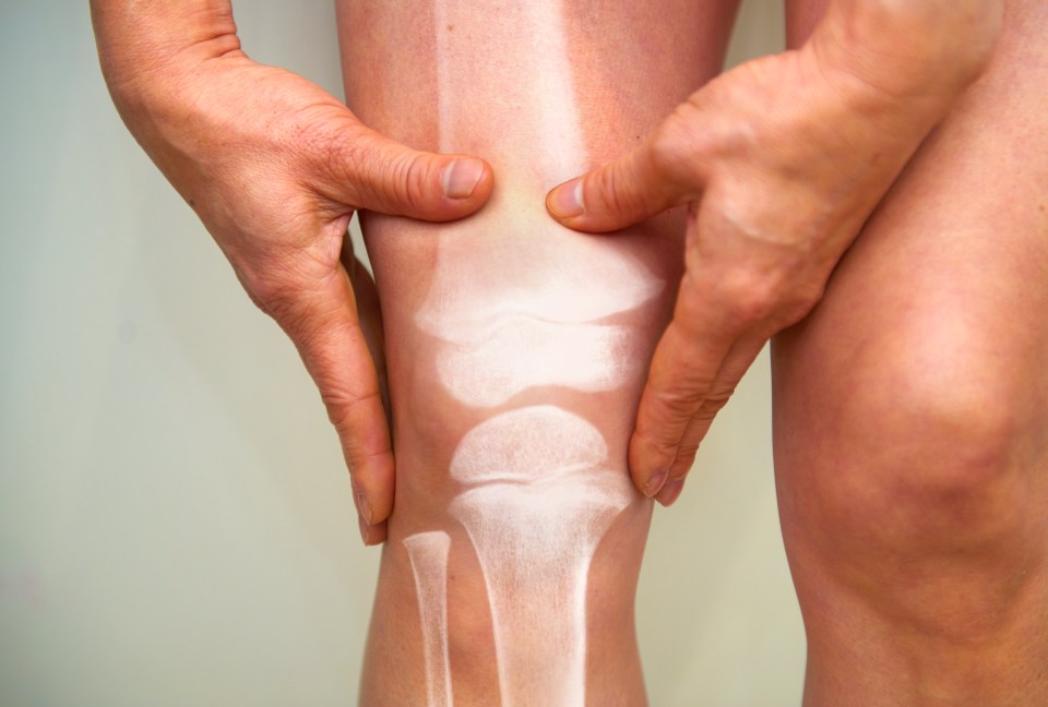 Osteoarthritis  is a joint disease that happens when the cartilage that cushions the ends of bones wears down over time