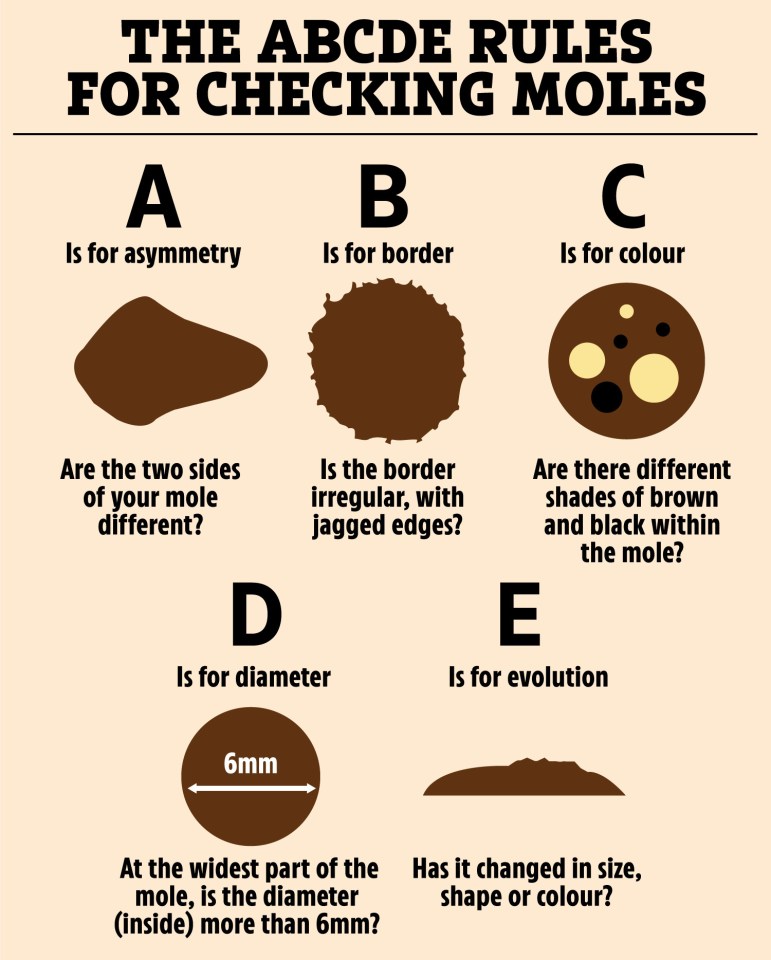 a poster explaining the rules for checking moles